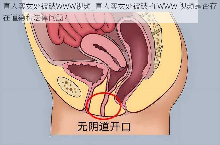 直人实女处被破WWW视频_直人实女处被破的 WWW 视频是否存在道德和法律问题？