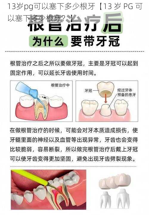 13岁pg可以塞下多少根牙【13 岁 PG 可以塞下多少根牙？】