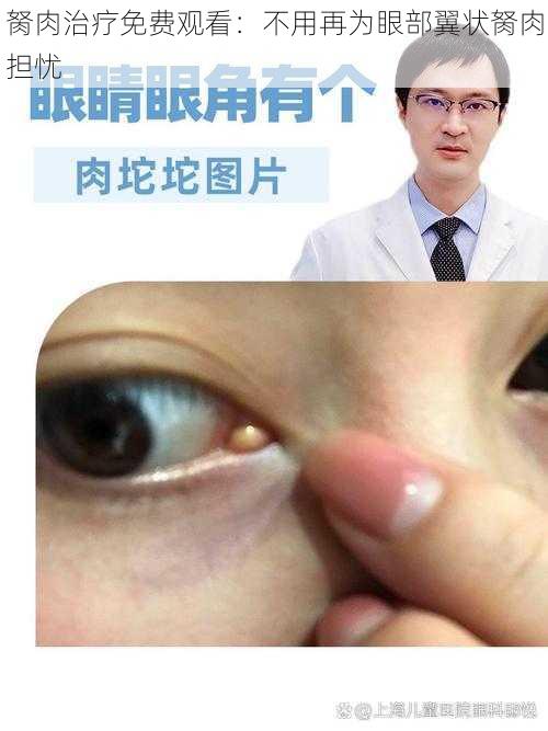 胬肉治疗免费观看：不用再为眼部翼状胬肉担忧